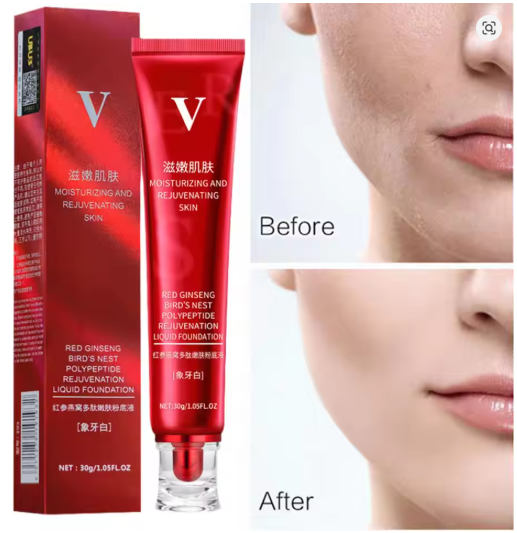 FV Red Upgrade Foundation